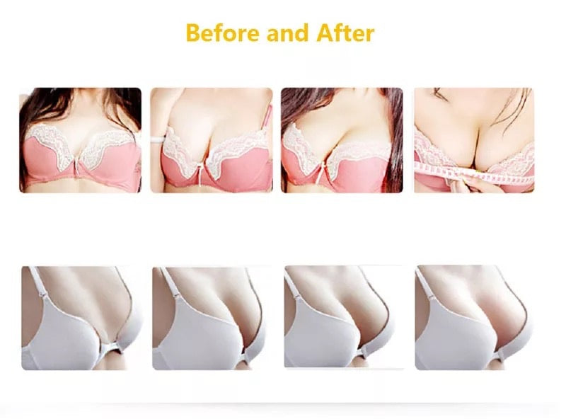 Novina Body Shaping Vacuum Therapy Machine with XXL Cups