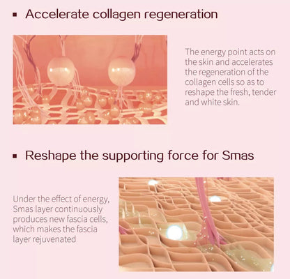 Mini HIFU Ultrasound Machine, accelerates collagen, reshape smas