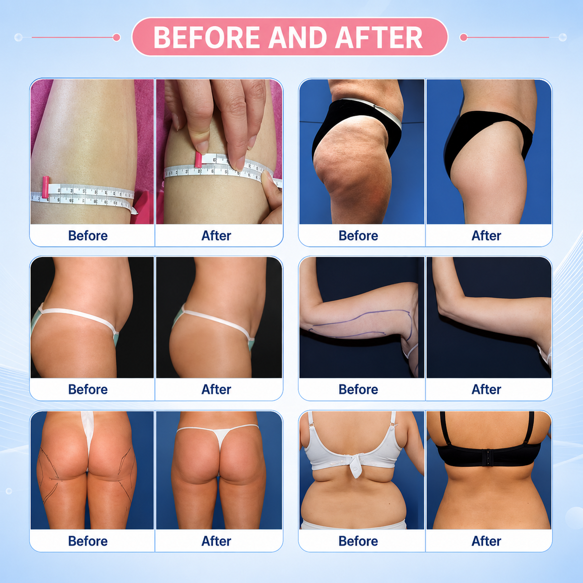 Lipo Laser 40K Cavitation Slimming Machine 6 in 1