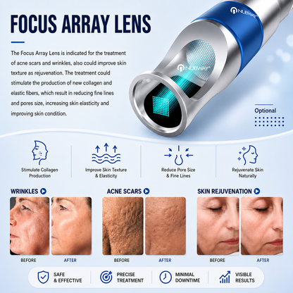 Laser Tattoo Removal Machine PicoLITE*