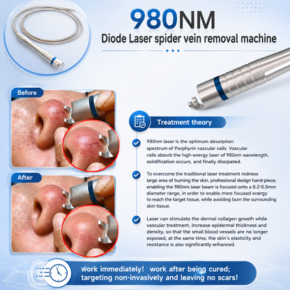 Spider Veins Laser Removal Machine 980nm Diode Laser*